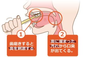 喉口臭