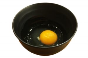 カラザが出来る理由と大きい場合の対処について